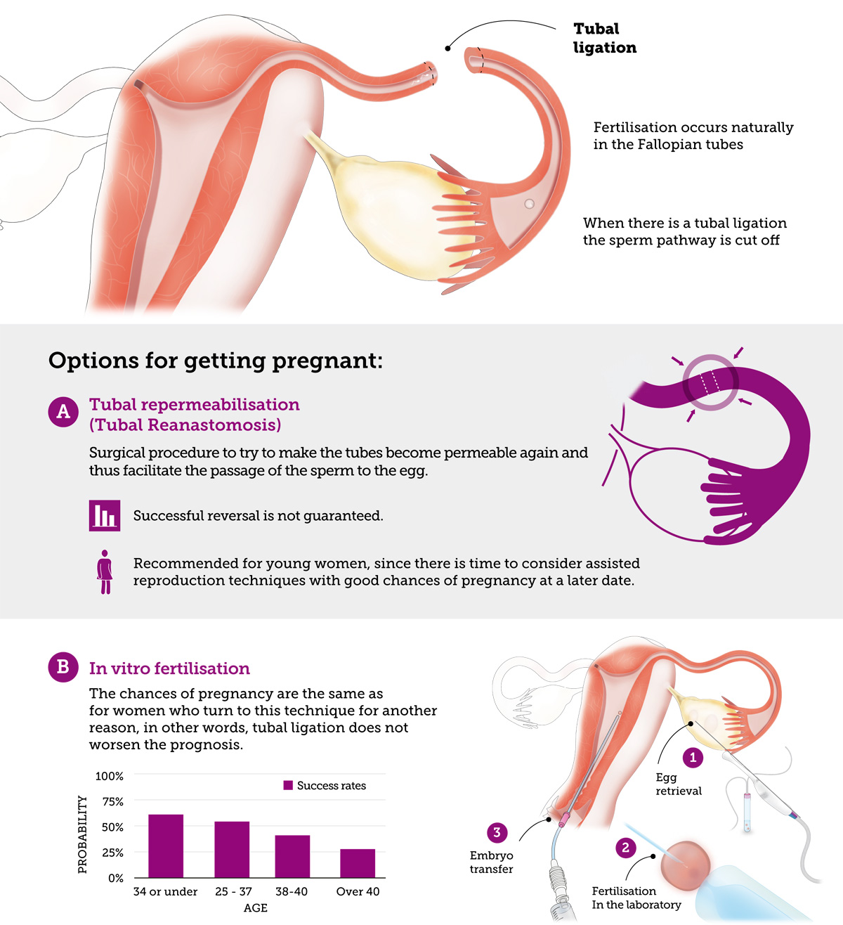 інфографіка про шанси завагітніти при стерилізації маткових труб